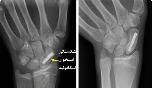 معرفی رشته پزشکی تیم مشاوره کنکور پروتون